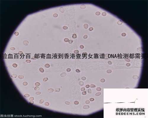 都是香港验血百分百_邮寄血液到香港查男女靠谱_DNA检测都需要哪些条件