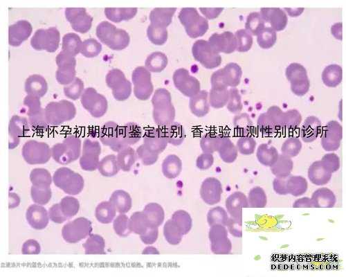 上海怀孕初期如何鉴定性别,香港验血测性别的诊所