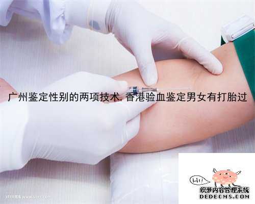 广州鉴定性别的两项技术,香港验血鉴定男女有打胎过