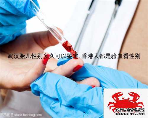 武汉胎儿性别多久可以鉴定,香港人都是验血看性别