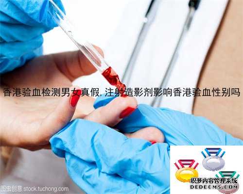 香港验血检测男女真假,注射造影剂影响香港验血性别吗