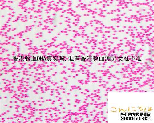 香港验血DNA真实吗,谁有香港验血测男女准不准
